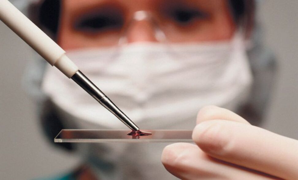 esame del sangue per i parassiti