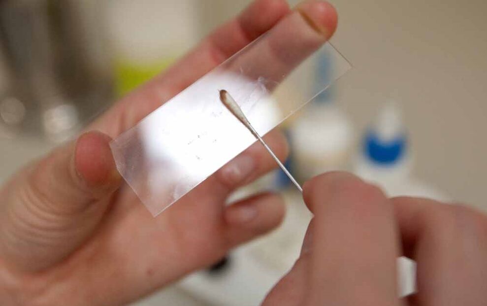 raschiando per la presenza di parassiti nel corpo