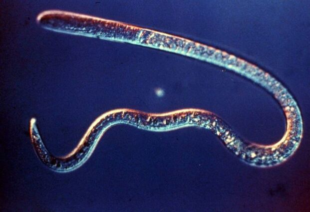 trichinella dal corpo umano