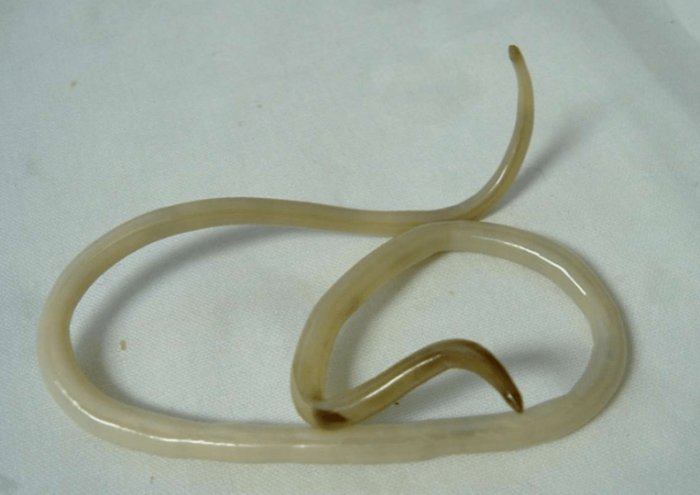verme dal corpo umano e il suo trattamento